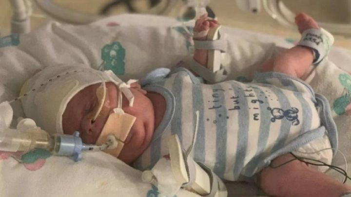 Bebé guerrero: nació con 765 gramos y sobrevivió al coronavirus