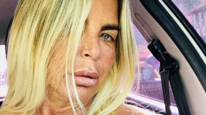 Raquel Mancini tendrá que hacer rehabilitación tras haber sido dada de alta