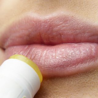 Todo lo que debes saber sobre el herpes labial